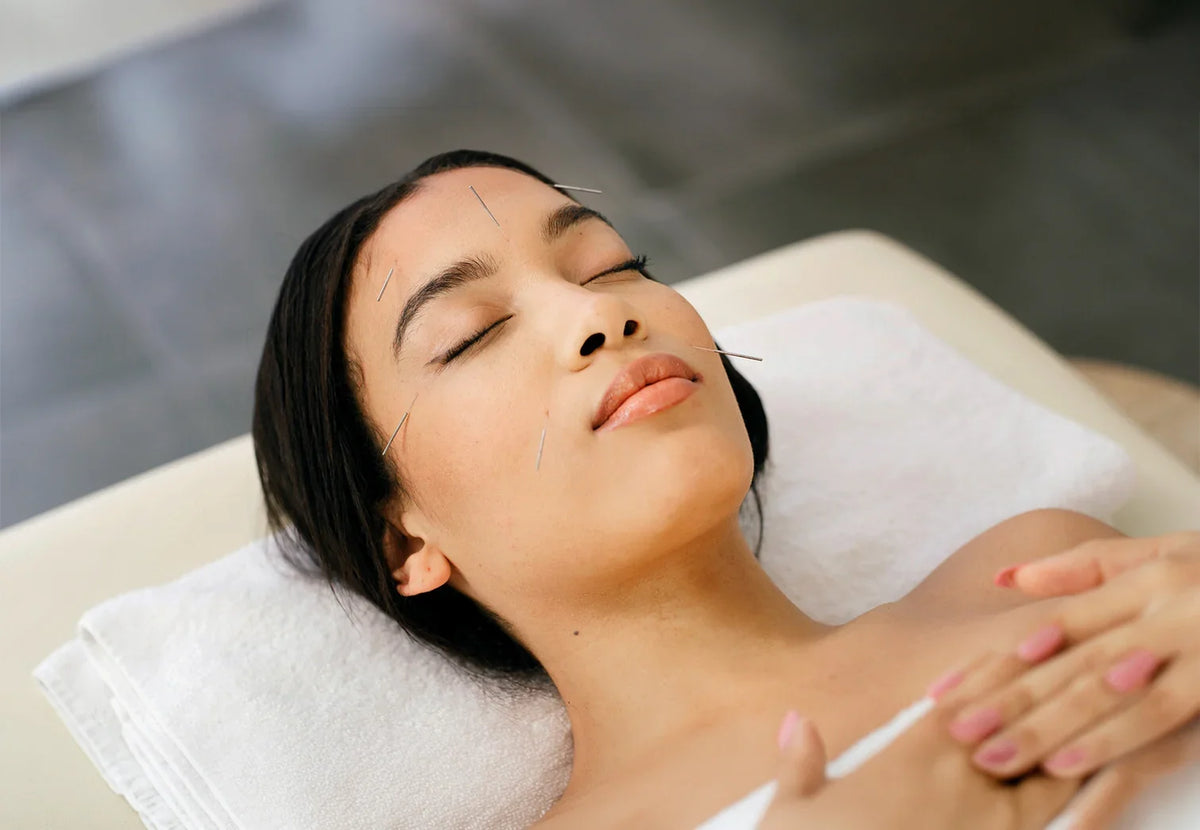 Woman receiving facial cosmetic acupuncture treatment in a relaxing spa setting.