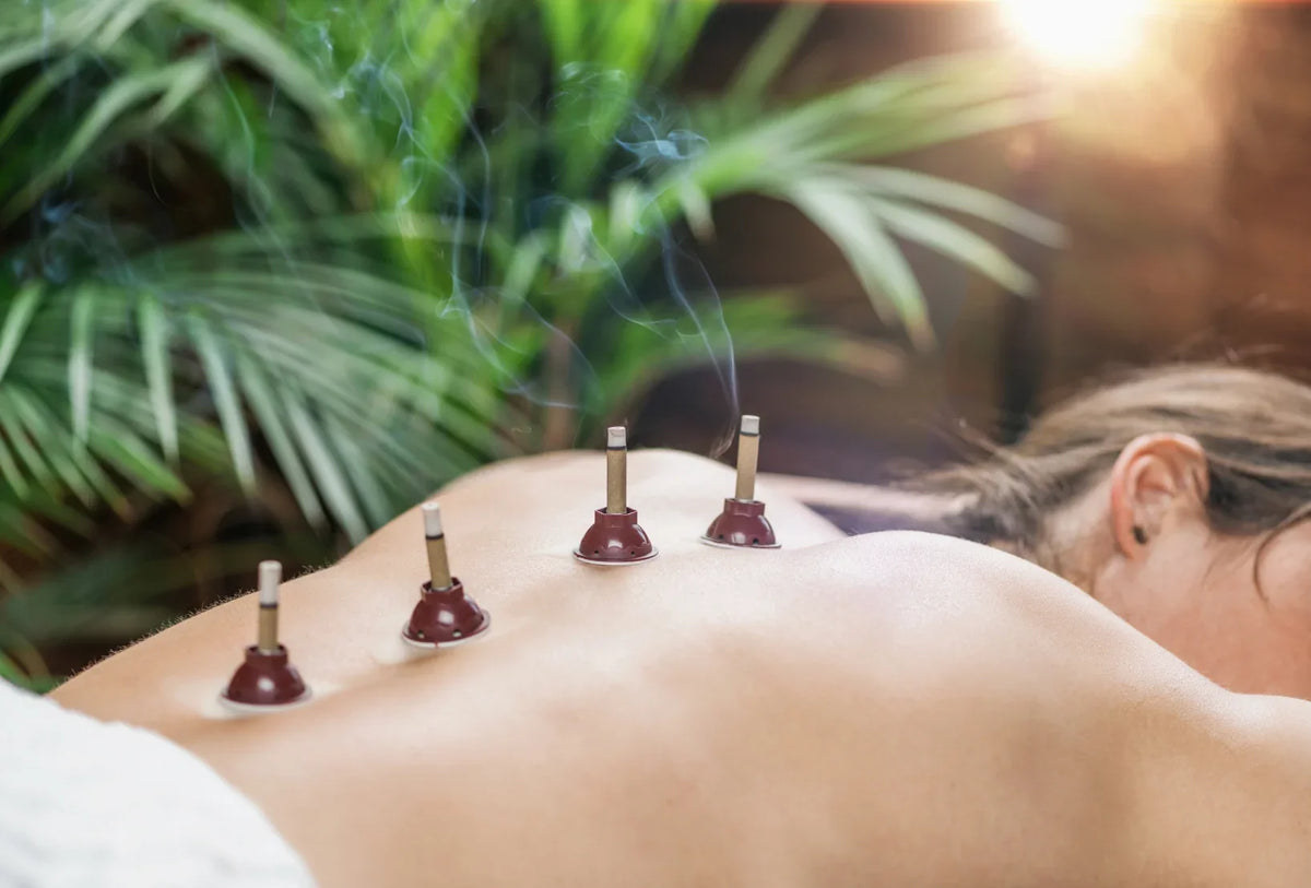 Person receiving traditional fire cupping therapy on their back in a relaxing setting.