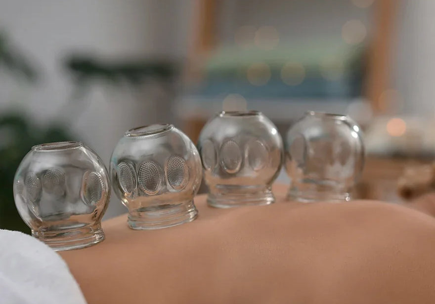 Glass cupping therapy session on a person's back for holistic wellness