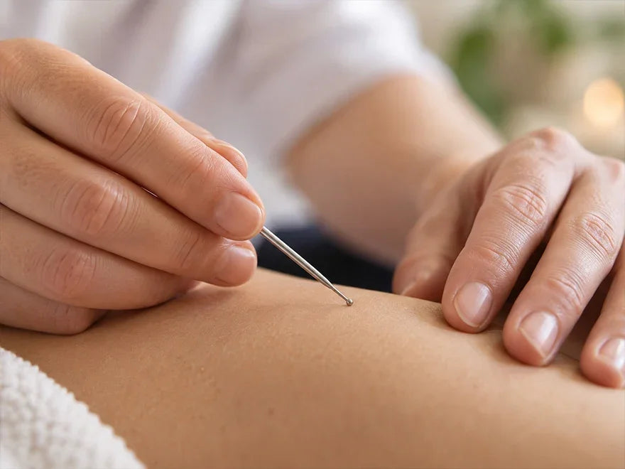 Practitioner performing acupuncture treatment on a client's back in a clinic setting.